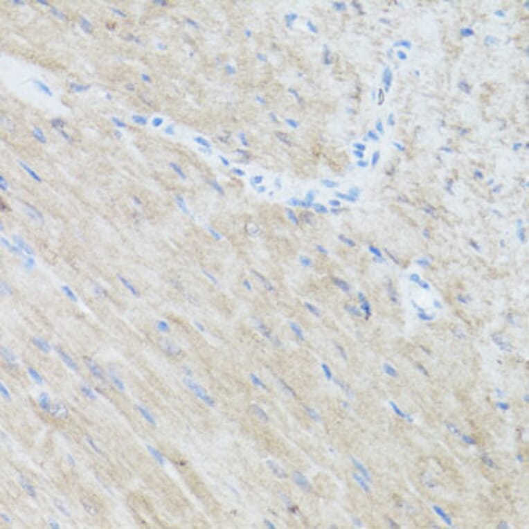 Immunohistochemistry - Anti-CLUH Antibody (A11250) - Antibodies.com