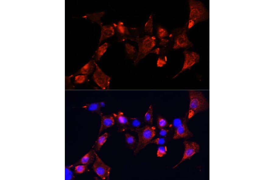 Immunofluorescence - Anti-CLUH Antibody (A11250) - Antibodies.com