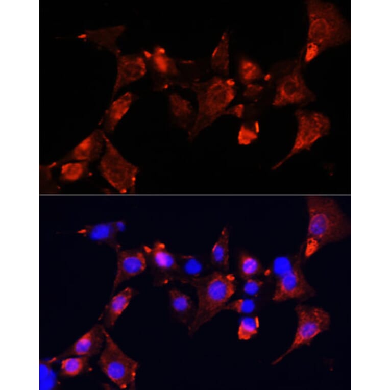 Immunofluorescence - Anti-CLUH Antibody (A11250) - Antibodies.com