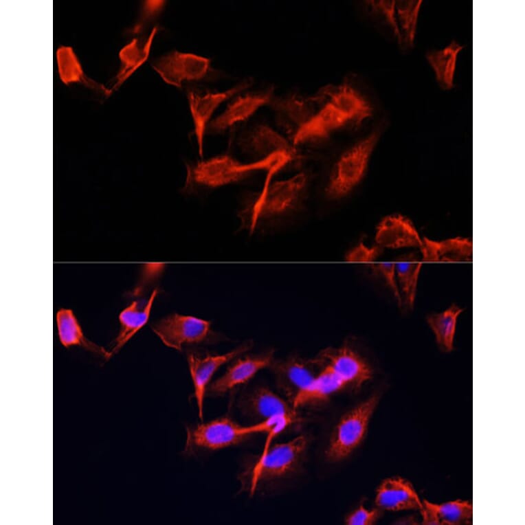 Immunofluorescence - Anti-CLUH Antibody (A11250) - Antibodies.com