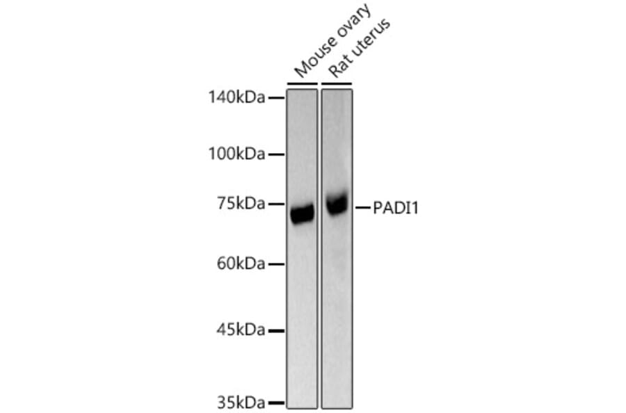 Western Blot - Anti-PADI1/PAD1 Antibody (A11251) - Antibodies.com