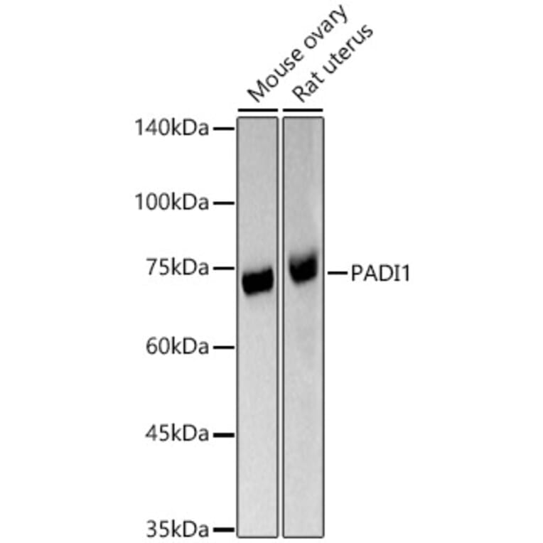Western Blot - Anti-PADI1/PAD1 Antibody (A11251) - Antibodies.com