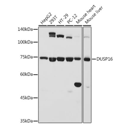 Western Blot - Anti-DUSP16 Antibody (A11253) - Antibodies.com