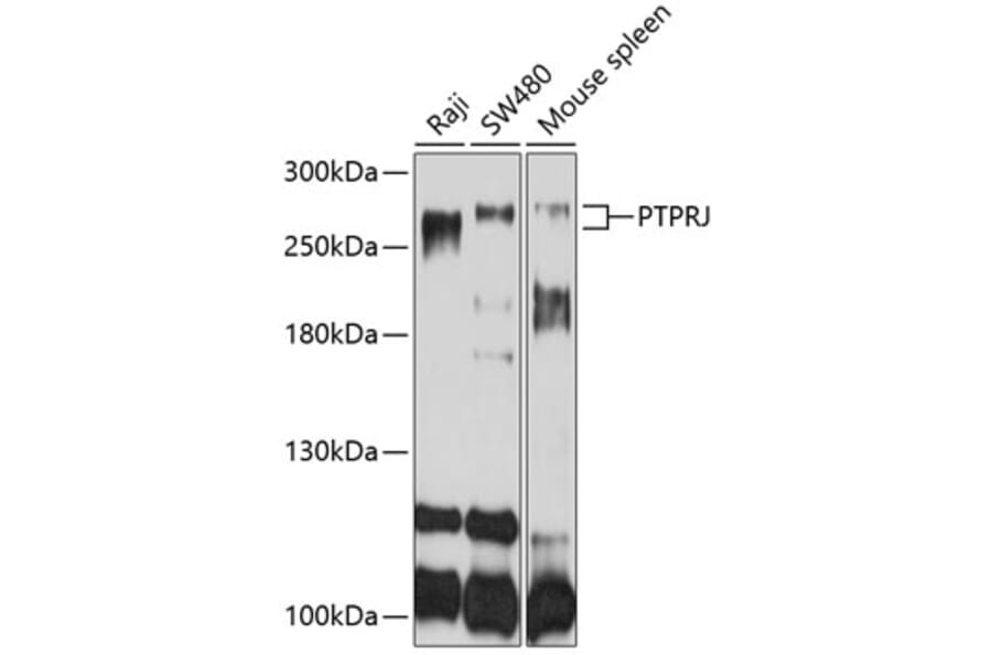 Western Blot - Anti-PTPRJ Antibody (A10169) - Antibodies.com