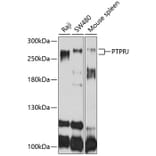 Western Blot - Anti-PTPRJ Antibody (A10169) - Antibodies.com