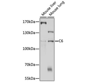 Western Blot - Anti-C6 Antibody (A11255) - Antibodies.com