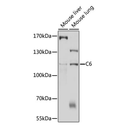 Western Blot - Anti-C6 Antibody (A11255) - Antibodies.com