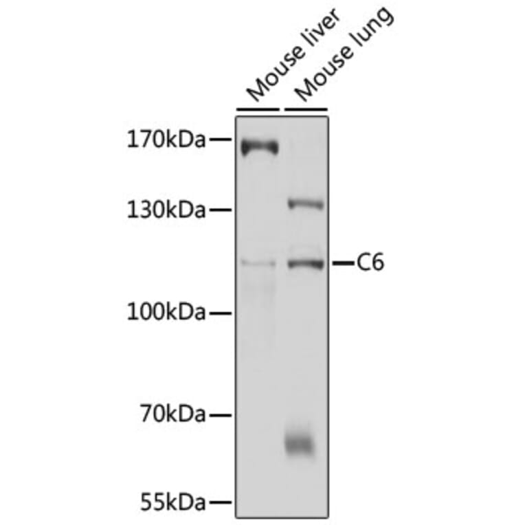 Western Blot - Anti-C6 Antibody (A11255) - Antibodies.com