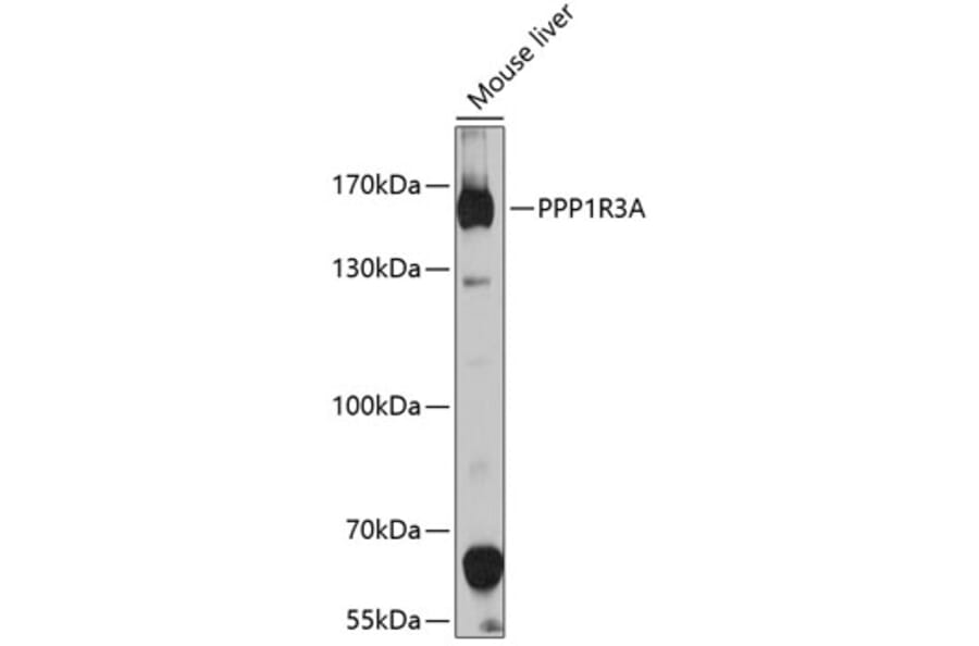 Western Blot - Anti-PPP1R3A Antibody (A10171) - Antibodies.com