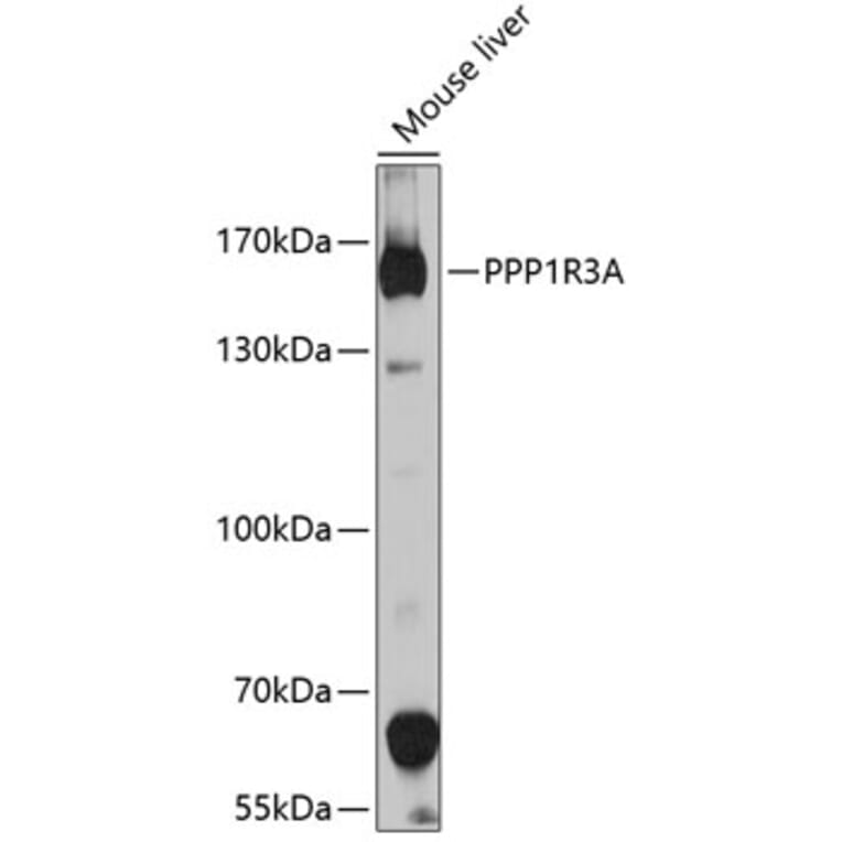 Western Blot - Anti-PPP1R3A Antibody (A10171) - Antibodies.com