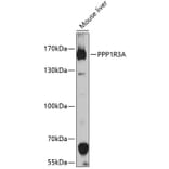 Western Blot - Anti-PPP1R3A Antibody (A10171) - Antibodies.com