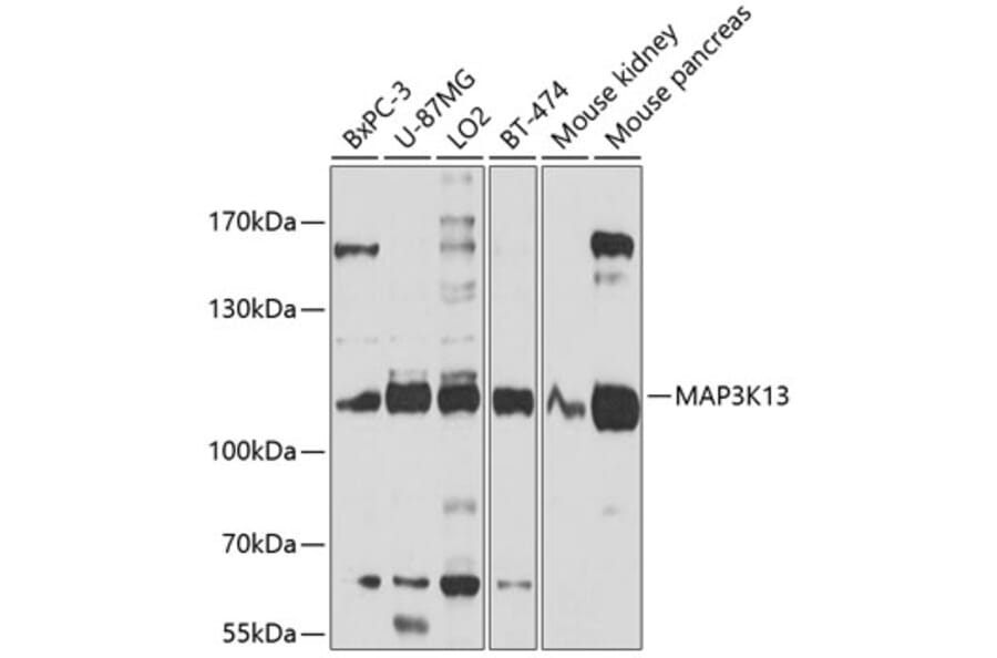 Western Blot - Anti-MAP3K13 Antibody (A10189) - Antibodies.com