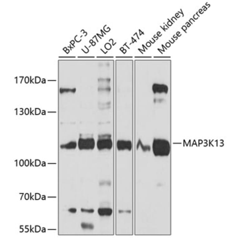 Western Blot - Anti-MAP3K13 Antibody (A10189) - Antibodies.com