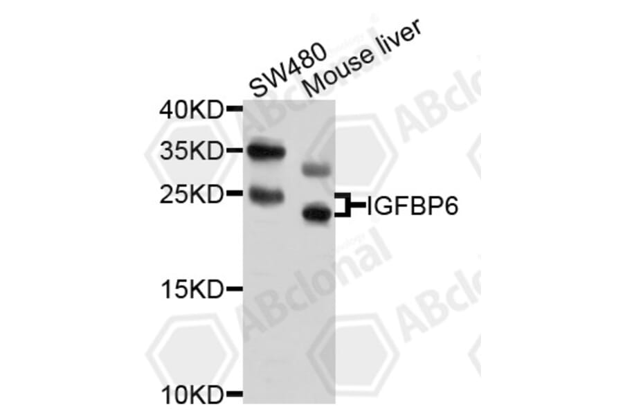 Western Blot - Anti-IGFBP6 Antibody (A10195) - Antibodies.com