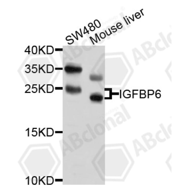 Western Blot - Anti-IGFBP6 Antibody (A10195) - Antibodies.com
