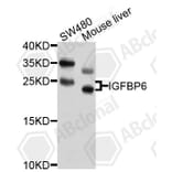 Western Blot - Anti-IGFBP6 Antibody (A10195) - Antibodies.com