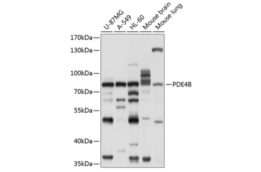 Western Blot - Anti-PDE4B Antibody (A11261) - Antibodies.com