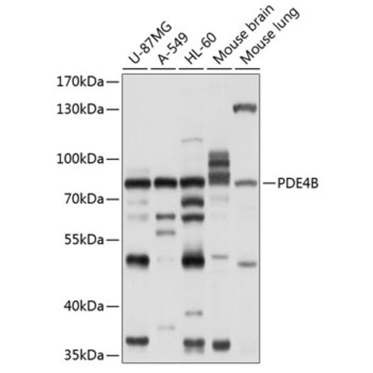 Western Blot - Anti-PDE4B Antibody (A11261) - Antibodies.com