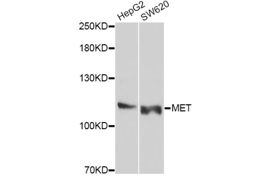 Western Blot - Anti-MET Antibody (A10199) - Antibodies.com