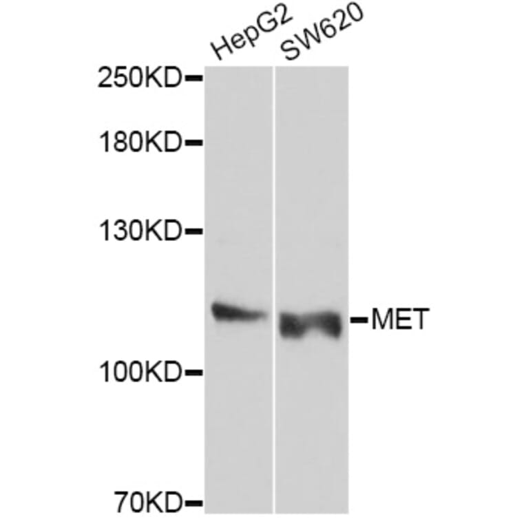 Western Blot - Anti-MET Antibody (A10199) - Antibodies.com