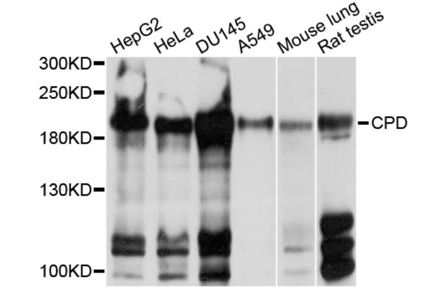 Western Blot - Anti-CPD Antibody (A10208) - Antibodies.com