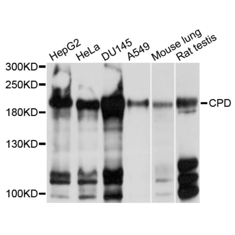 Western Blot - Anti-CPD Antibody (A10208) - Antibodies.com