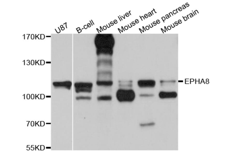 Western Blot - Anti-EPHA8 Antibody (A10213) - Antibodies.com