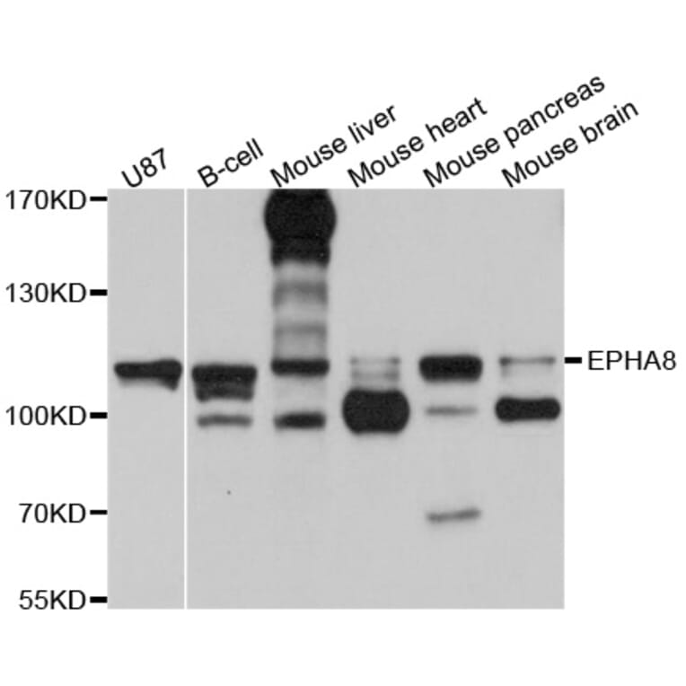 Western Blot - Anti-EPHA8 Antibody (A10213) - Antibodies.com