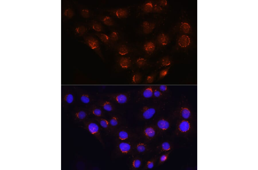 Immunofluorescence - Anti-Golgin-245 Antibody (A11266) - Antibodies.com