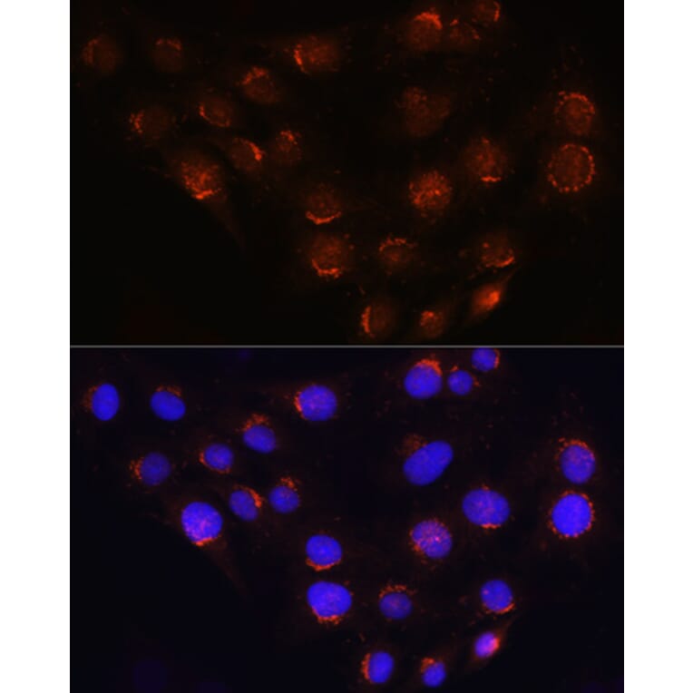 Immunofluorescence - Anti-Golgin-245 Antibody (A11266) - Antibodies.com