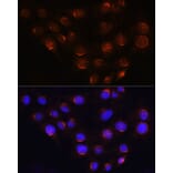 Immunofluorescence - Anti-Golgin-245 Antibody (A11266) - Antibodies.com