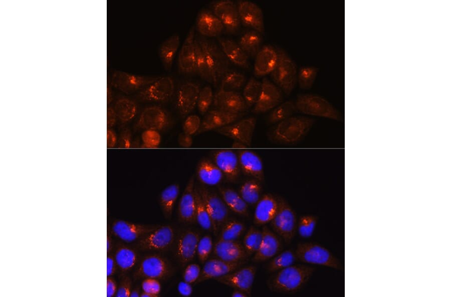 Immunofluorescence - Anti-Golgin-245 Antibody (A11266) - Antibodies.com