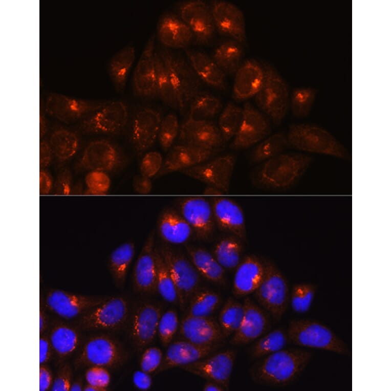 Immunofluorescence - Anti-Golgin-245 Antibody (A11266) - Antibodies.com