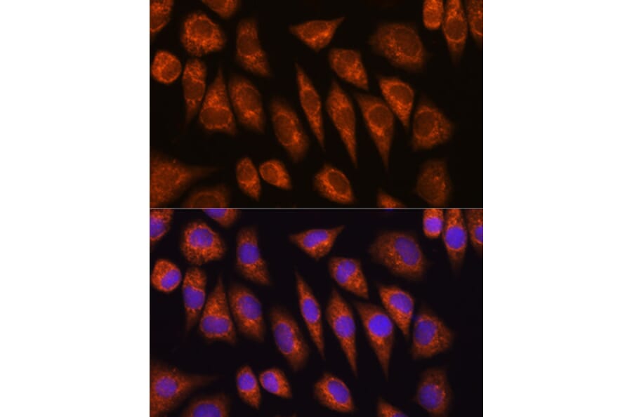 Immunofluorescence - Anti-Golgin-245 Antibody (A11266) - Antibodies.com