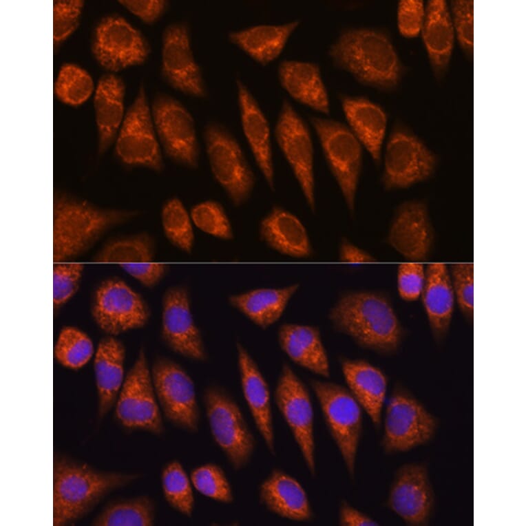 Immunofluorescence - Anti-Golgin-245 Antibody (A11266) - Antibodies.com