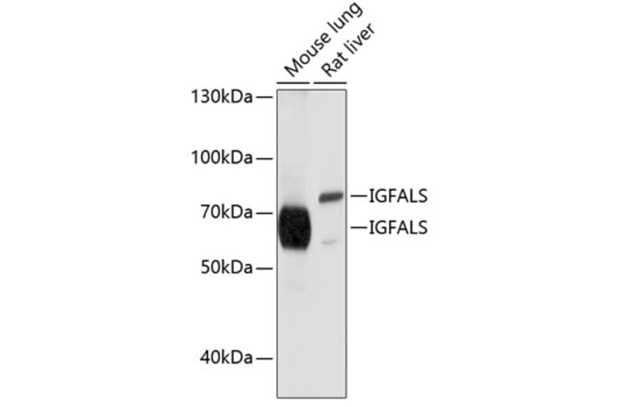 Western Blot - Anti-ALS Antibody (A11267) - Antibodies.com
