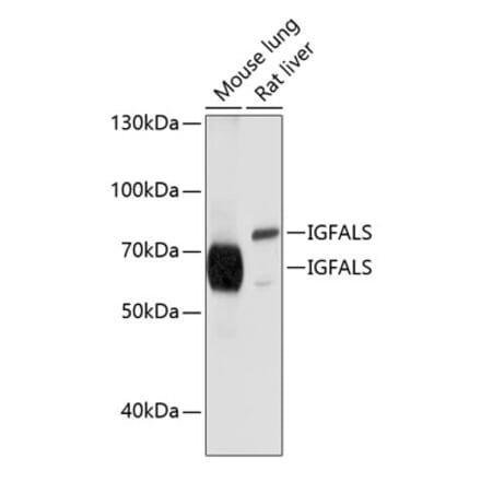 Western Blot - Anti-ALS Antibody (A11267) - Antibodies.com