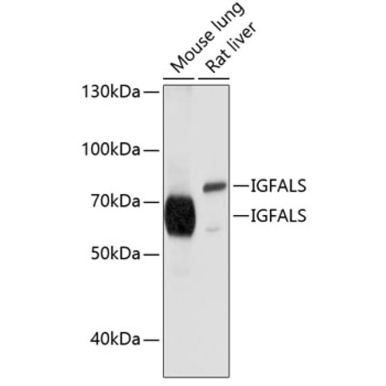 Western Blot - Anti-ALS Antibody (A11267) - Antibodies.com