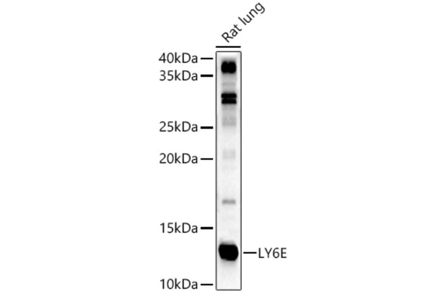 Western Blot - Anti-LY6E/SCA-2 Antibody (A11268) - Antibodies.com