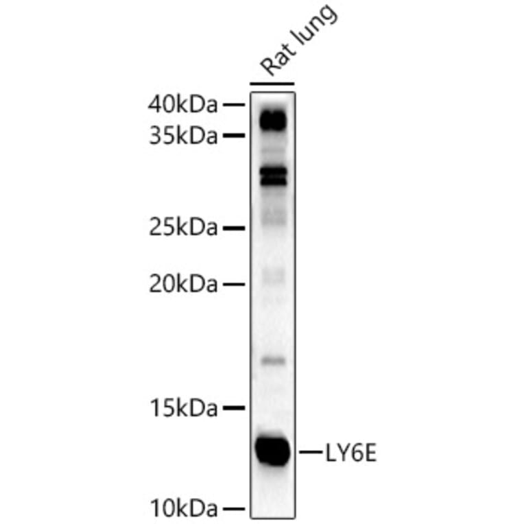 Western Blot - Anti-LY6E/SCA-2 Antibody (A11268) - Antibodies.com