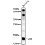 Western Blot - Anti-LY6E/SCA-2 Antibody (A11268) - Antibodies.com