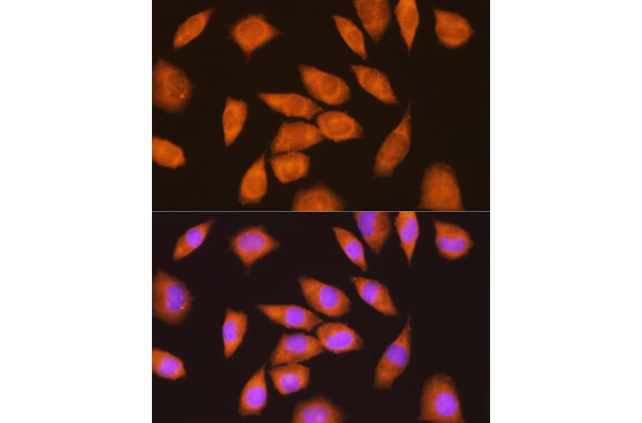 Immunofluorescence - Anti-LY6E/SCA-2 Antibody (A11268) - Antibodies.com