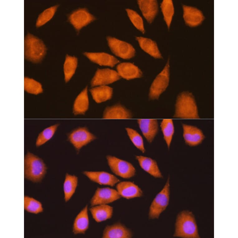 Immunofluorescence - Anti-LY6E/SCA-2 Antibody (A11268) - Antibodies.com