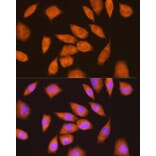 Immunofluorescence - Anti-LY6E/SCA-2 Antibody (A11268) - Antibodies.com