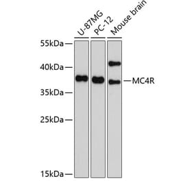 Western Blot - Anti-MC4-R Antibody (A11269) - Antibodies.com