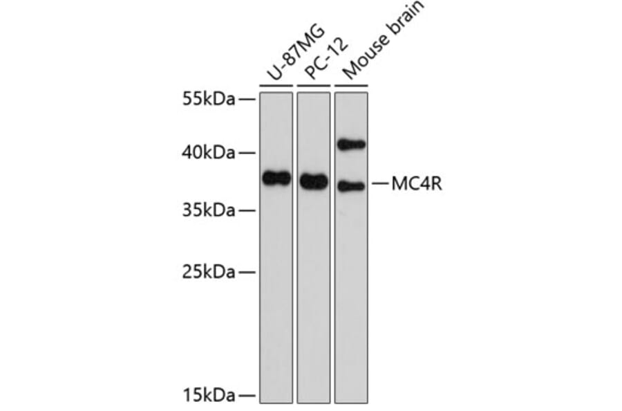 Anti-MC4R Antibody (A11269) | Antibodies.com