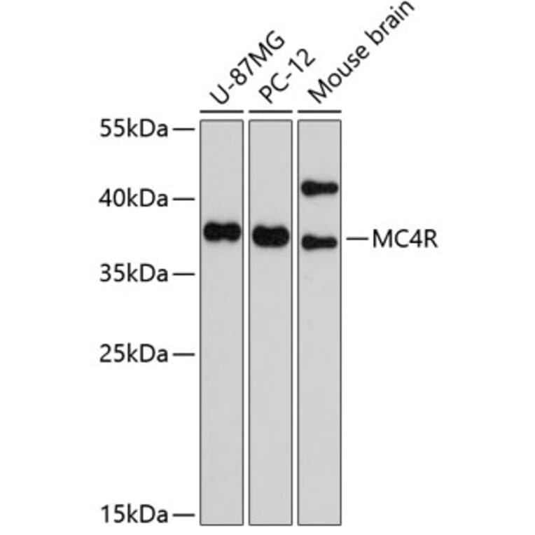 Western Blot - Anti-MC4-R Antibody (A11269) - Antibodies.com