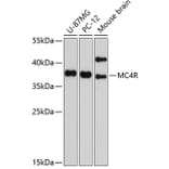 Western Blot - Anti-MC4-R Antibody (A11269) - Antibodies.com