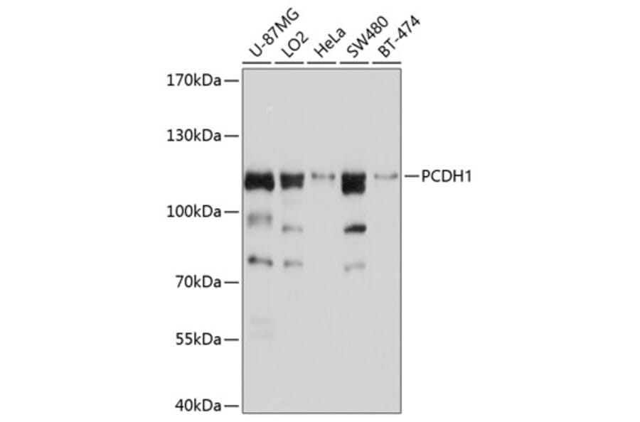 Western Blot - Anti-PCDH1 Antibody (A11270) - Antibodies.com