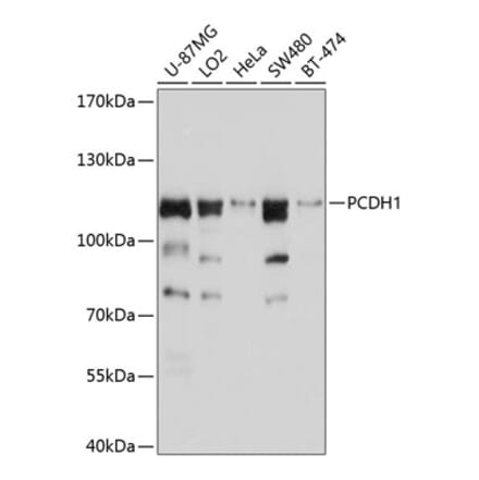 Western Blot - Anti-PCDH1 Antibody (A11270) - Antibodies.com